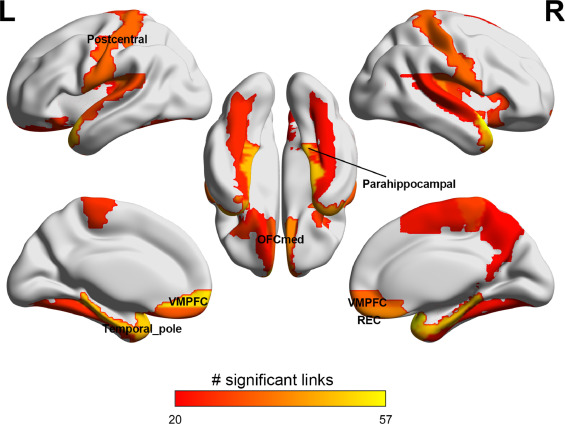 Risk-taking in the brain – The daily blog of behavioral and cognitive economics